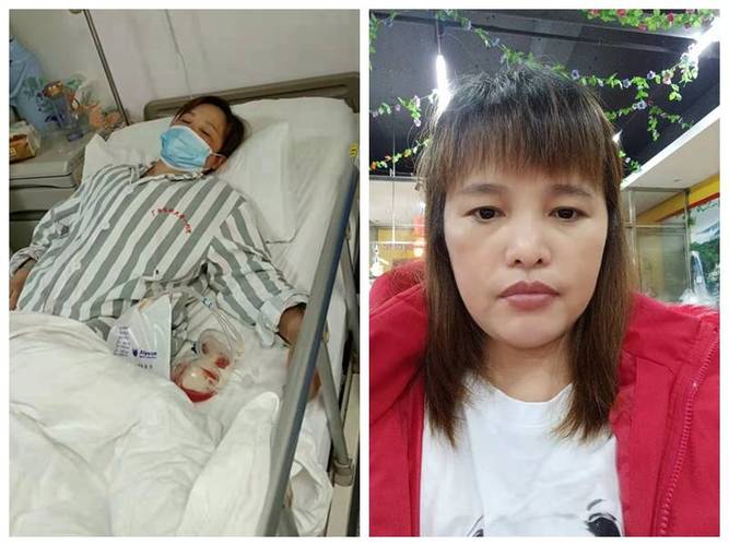抽烟43年妻子癌晚期