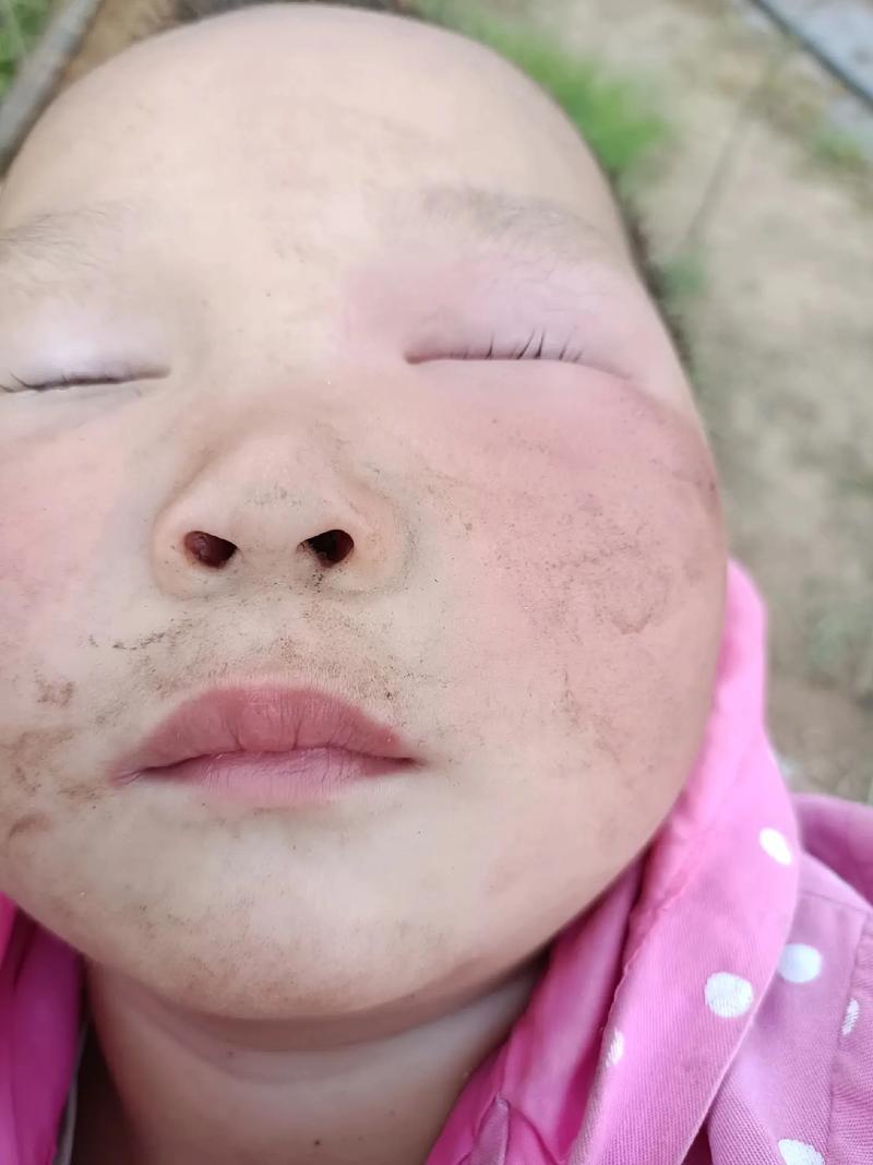 女童被蜜蜂蛰伤致死